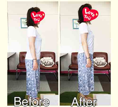 Before／AFTERの画像